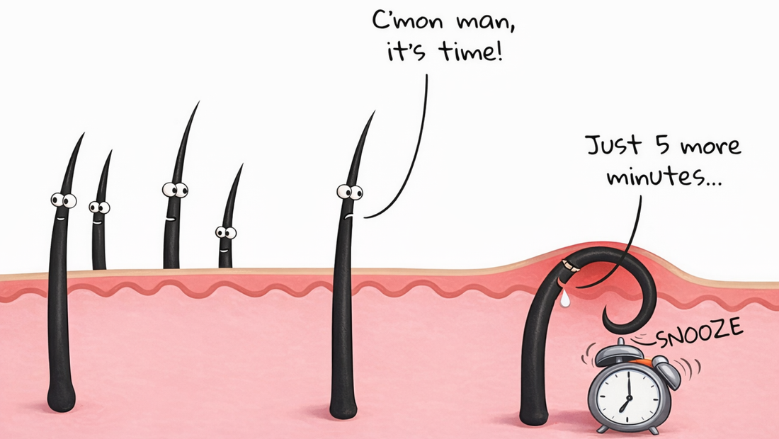 Why Ingrown Hairs Come Back Out of Nowhere