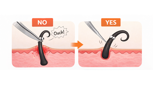 Infographic showing the right and wrong way to treat an ingrown hair by gently lifting it above the skin instead of pulling it out completely.